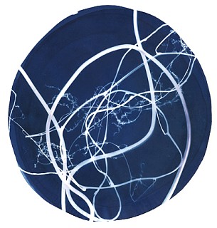 Arteriogram cyanotype